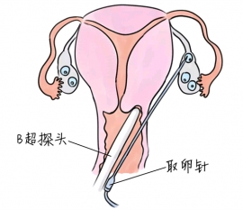 幼儿学画画，贵阳捐卵宝宝学画画，学画画的好处，如何学画画